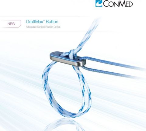 GraftMax Button